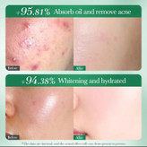 سرم ضد جوش و روشن کننده سادور مدل ANTI-ACNE مناسب برای پوستهای آکنهای حجم 30 میلیلیتر