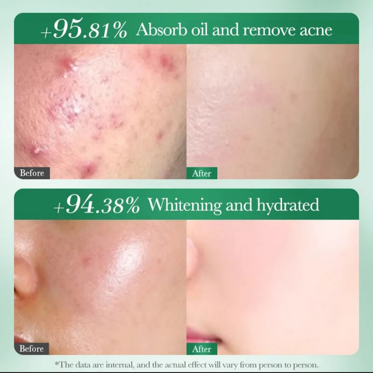 سرم ضد جوش و روشن کننده سادور مدل ANTI-ACNE مناسب برای پوستهای آکنهای حجم 30 میلیلیتر